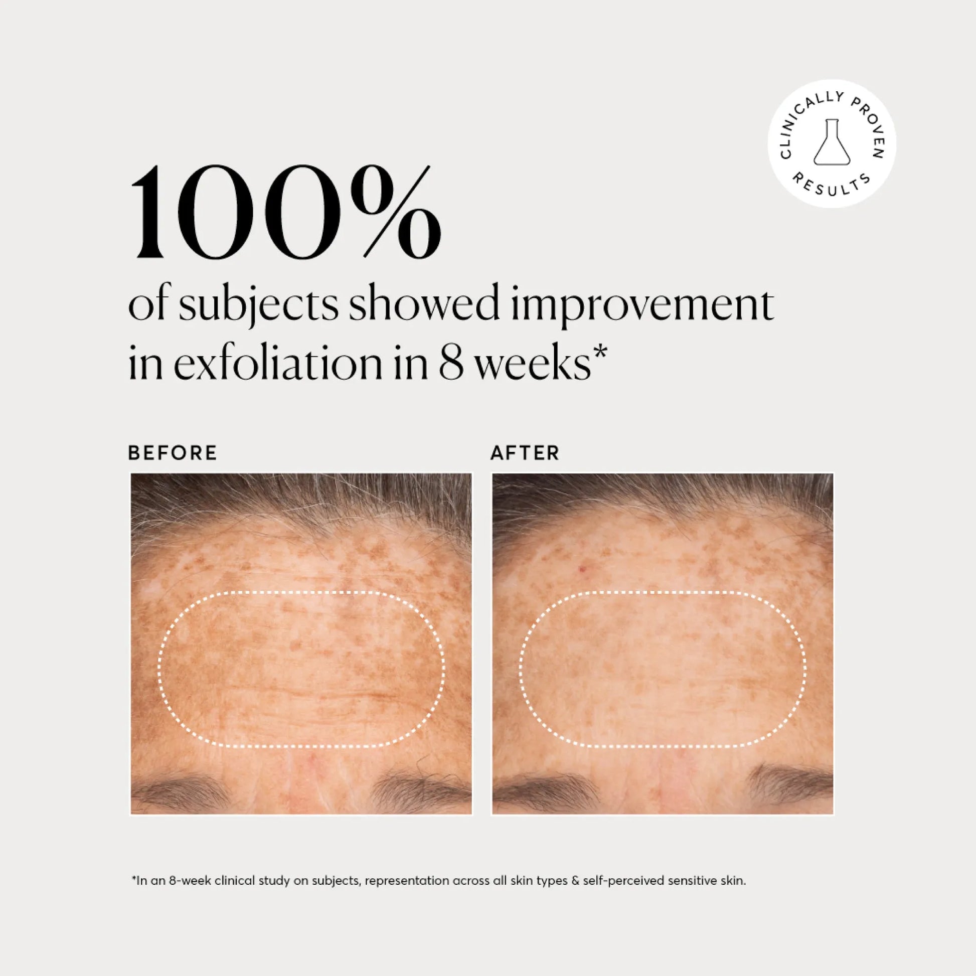 bha-liquid-exfoliant-2-s3 NATR-10027-Alt-Images-BHA-Liquid-Exfoliant-2_-03.webp