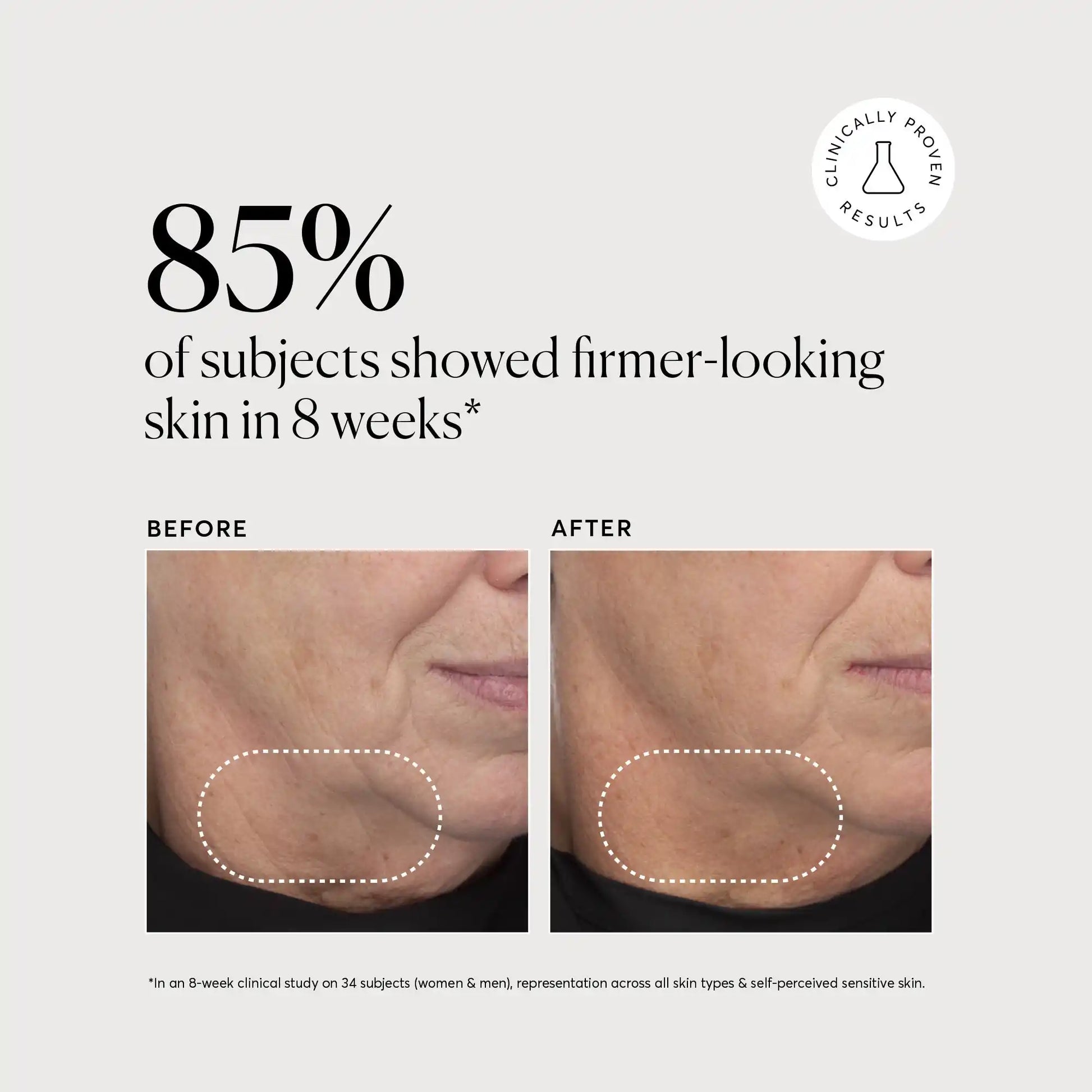 retinol-complex-serum-o5 NATR-10034-Alt-Images-Retinol-Complex-Serum-04.webp